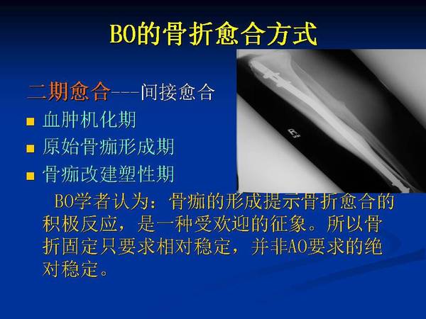 幻灯片31.JPG