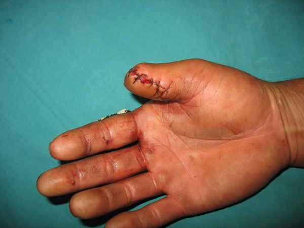 IMG_1606.JPG.thumb[1].jpg