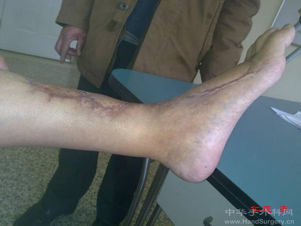 20111229254.jpg