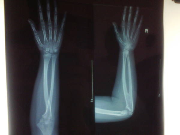 IMG_20120604_105558.jpg