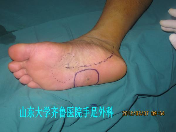 IMG_2709_conew1.jpg