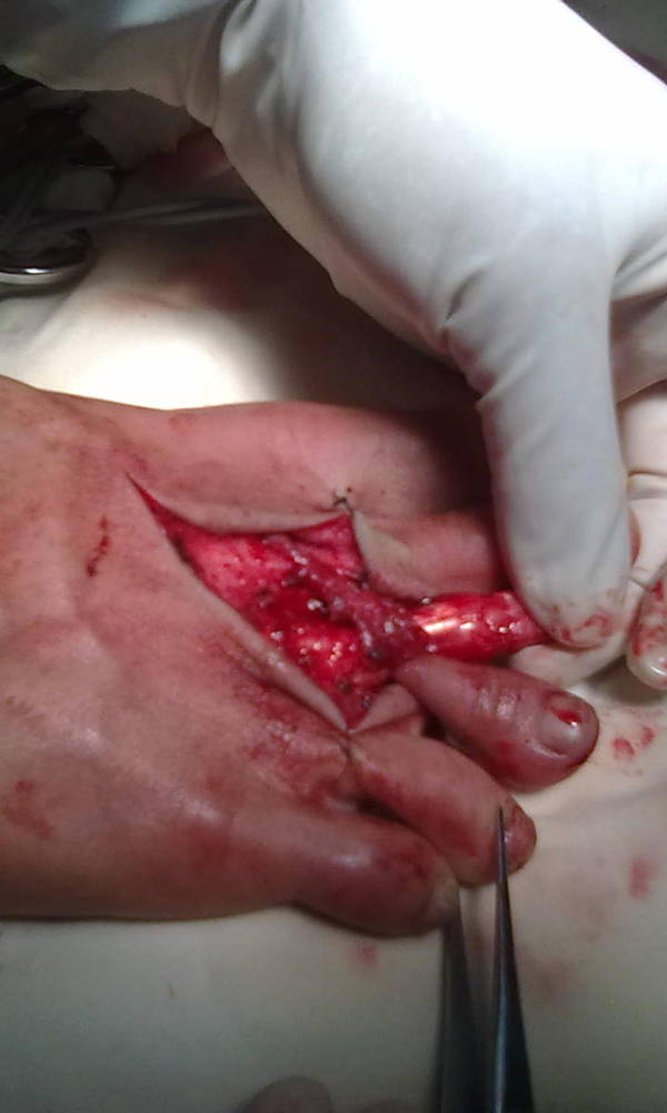 201204101722.jpg