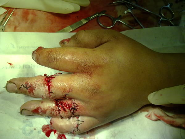 20111226568.jpg