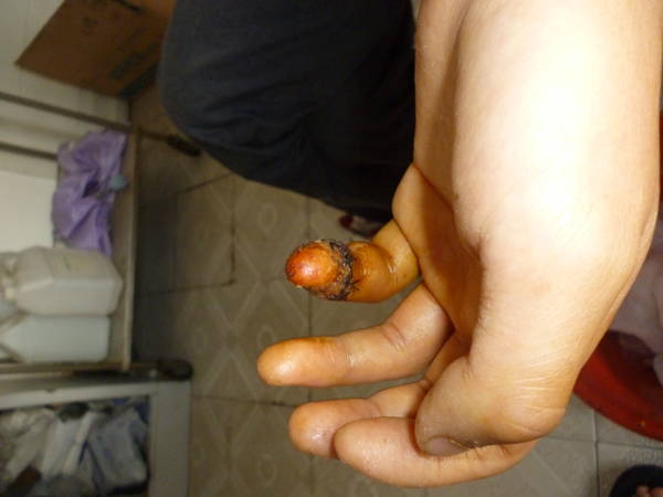 P1000551.JPG