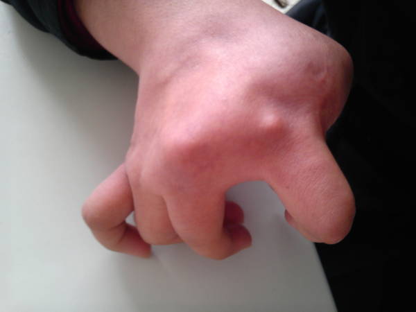 IMG_20111126_095729.jpg