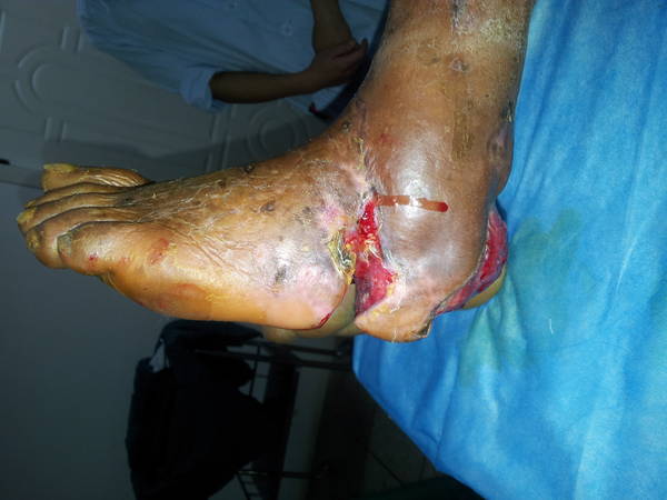 20120618_093707.jpg