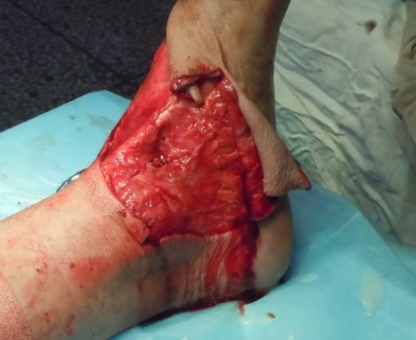 R$%LLEQAW3KG}4~Z](HP0@6.jpg