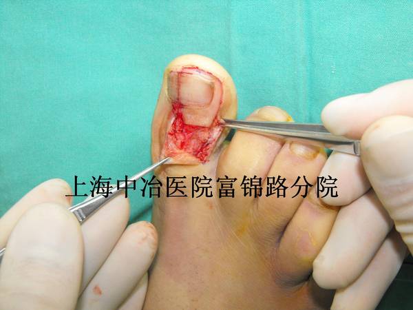 照片 008.jpg