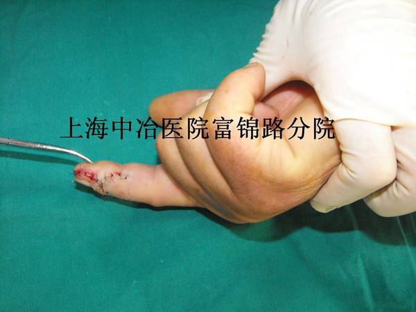 照片 036.jpg