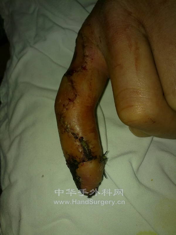 20120107473.jpg