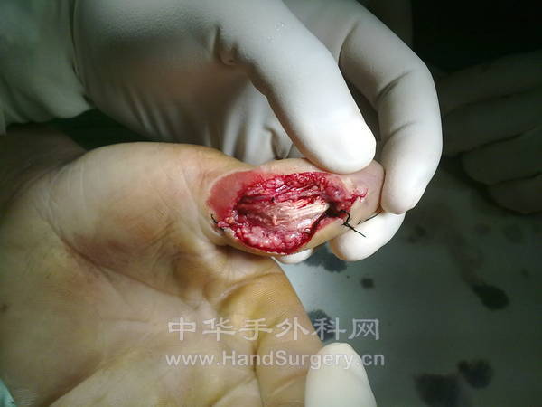 20110707538.jpg