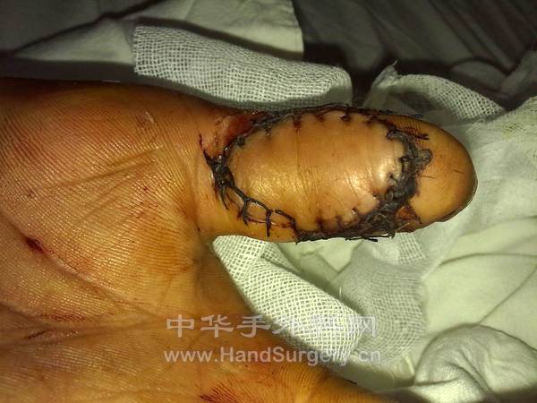 重新曝光 20110715555.jpg