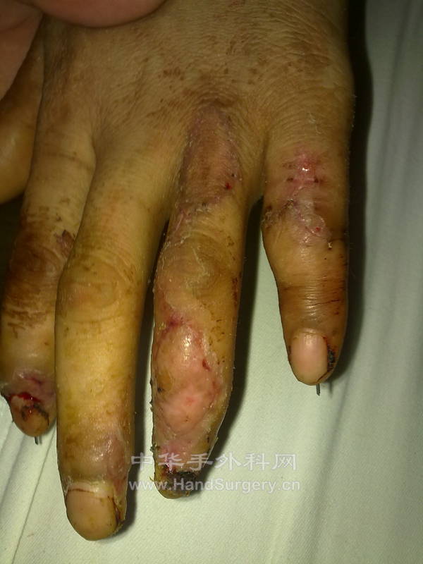 20110420243.jpg
