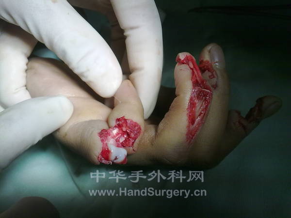 20110324083.jpg