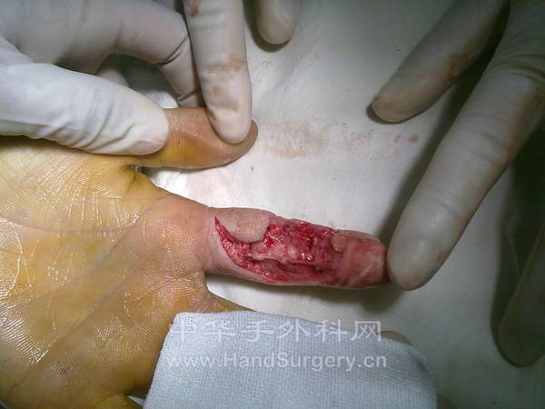 20110826774.jpg