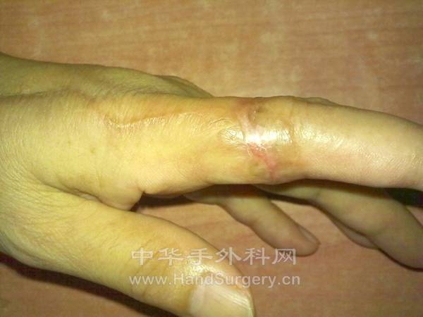 重新曝光 重新曝光 20110822763.jpg
