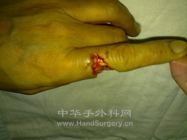 20110629507.jpg