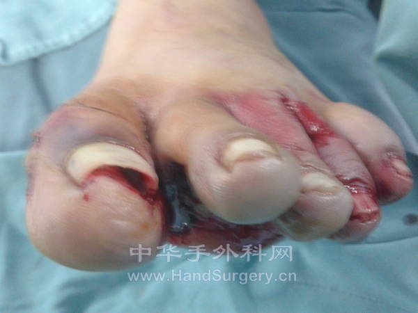 20120825_170641.jpg