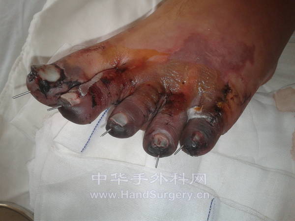 20120830_152300.jpg