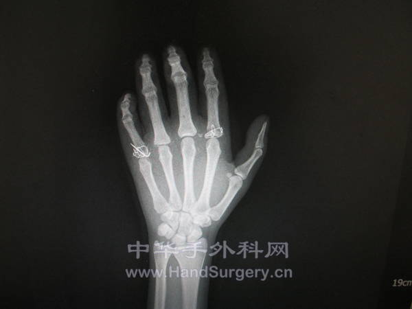 照片 1087.jpg
