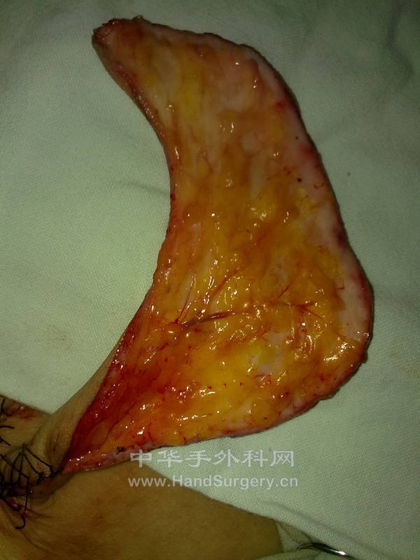 20120911365.jpg