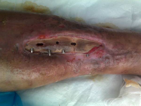 201208251856.jpg
