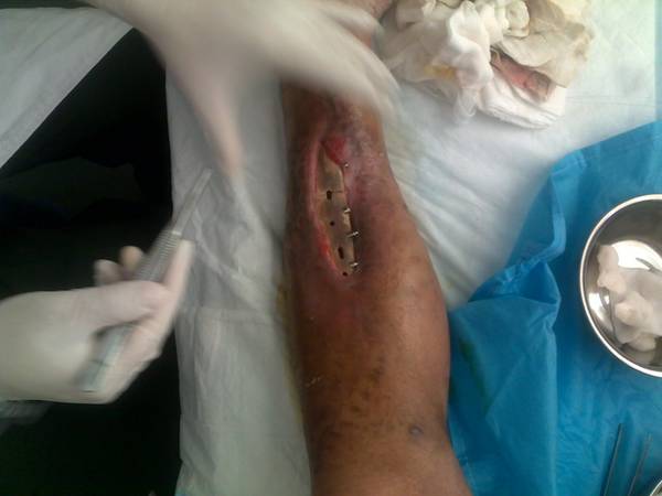 201208251857.jpg