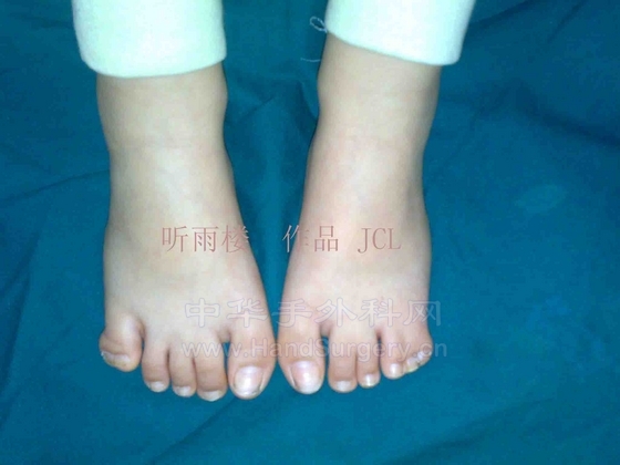 足背.jpg
