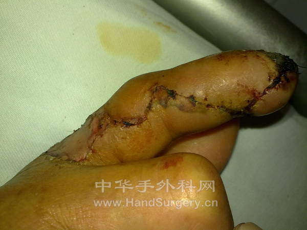 20120923469.jpg