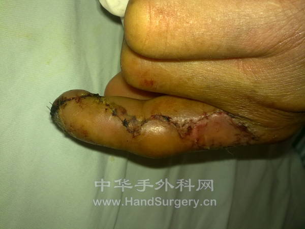 20120923472.jpg