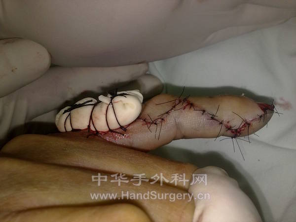 旋转 11092012265.jpg