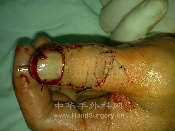 20120912386.jpg