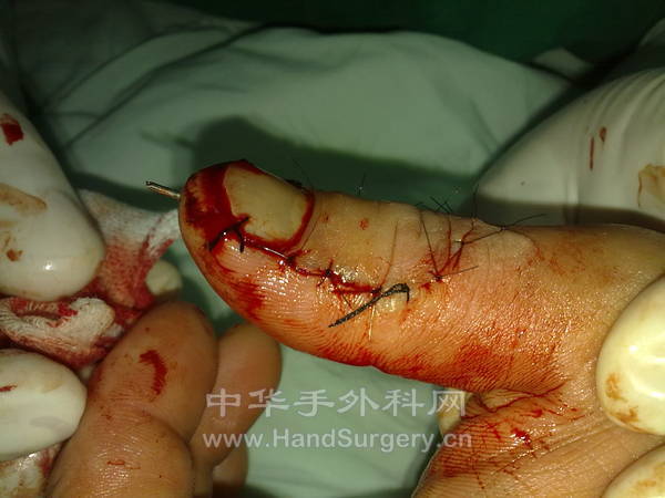 20120912387.jpg