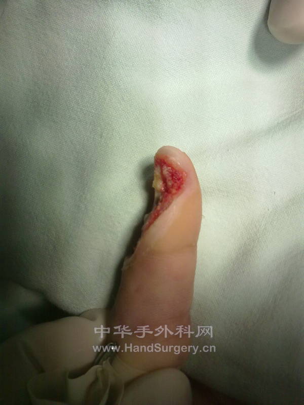20120920444.jpg