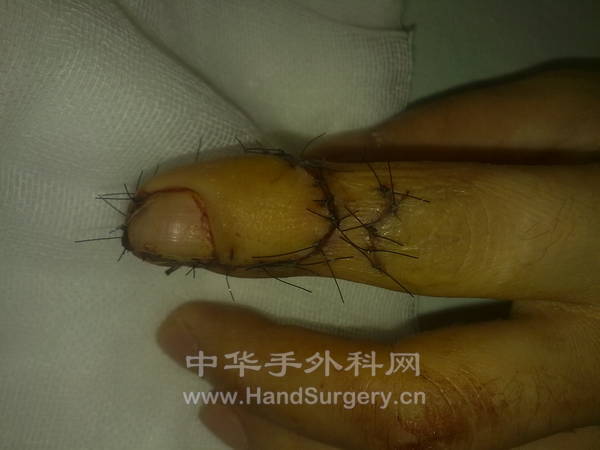 20120929494.jpg