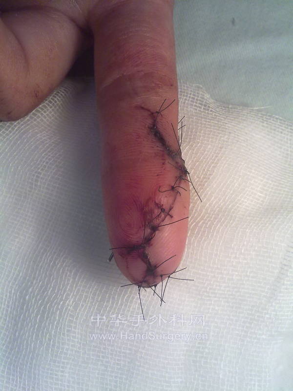 20120929505.jpg