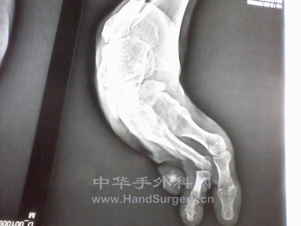 照片-0033.jpg