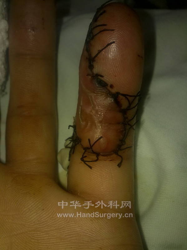 20120903229.jpg