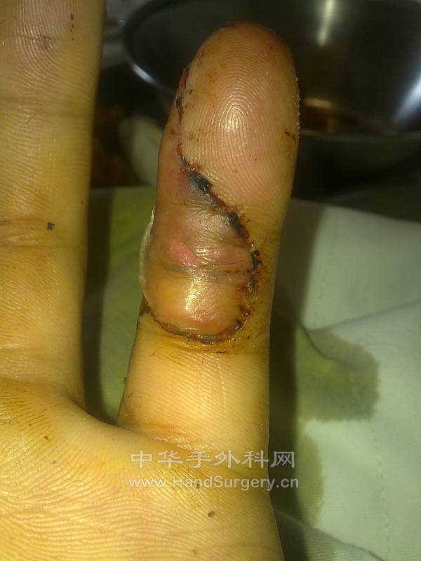 20120903248.jpg