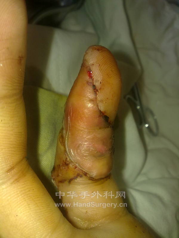 20120903250.jpg