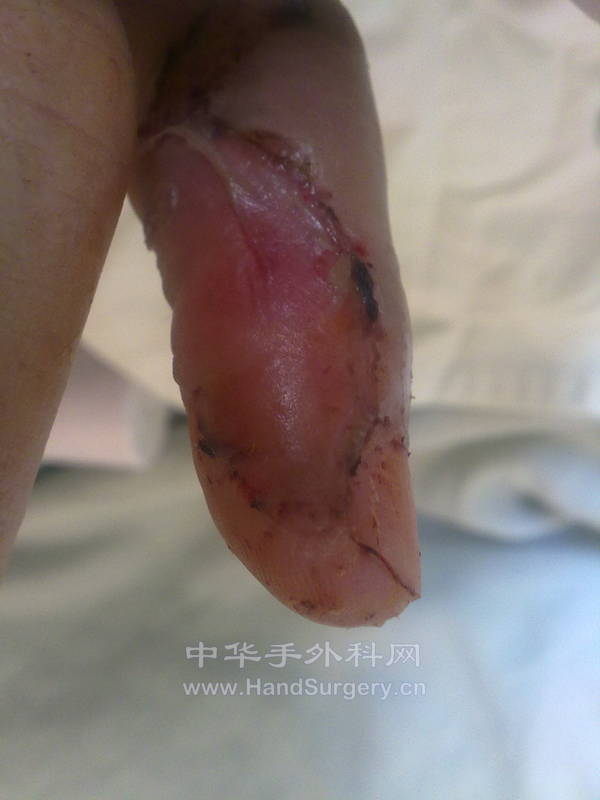 20120903251.jpg