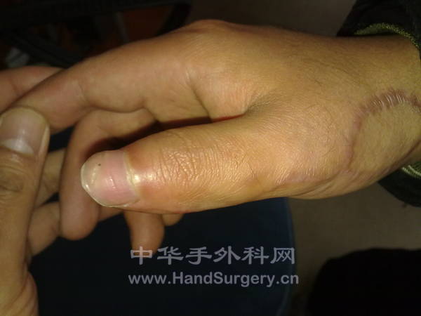 20120113535.jpg