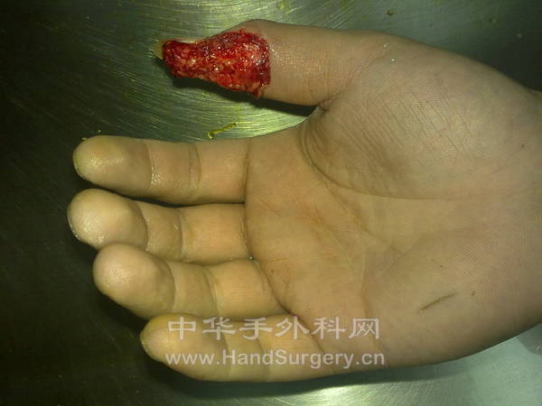 20110924839.jpg