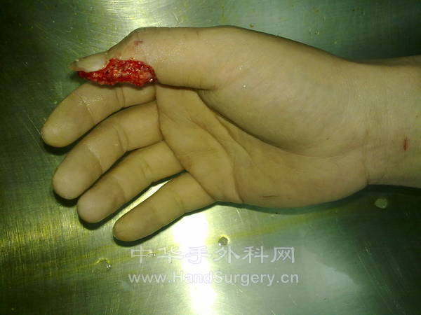 20110924840.jpg