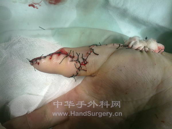 20110924845.jpg