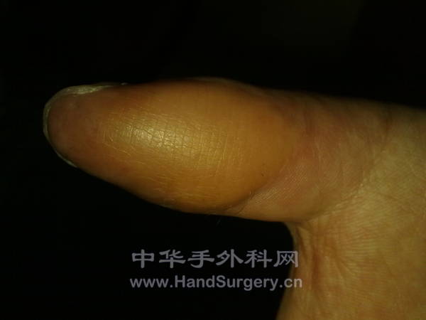 20120113533.jpg