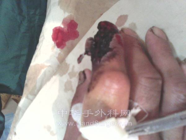 煤矿工人