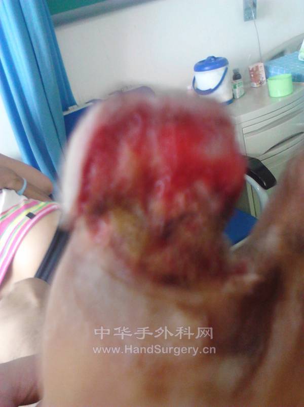 IMG_20120620_103454.jpg
