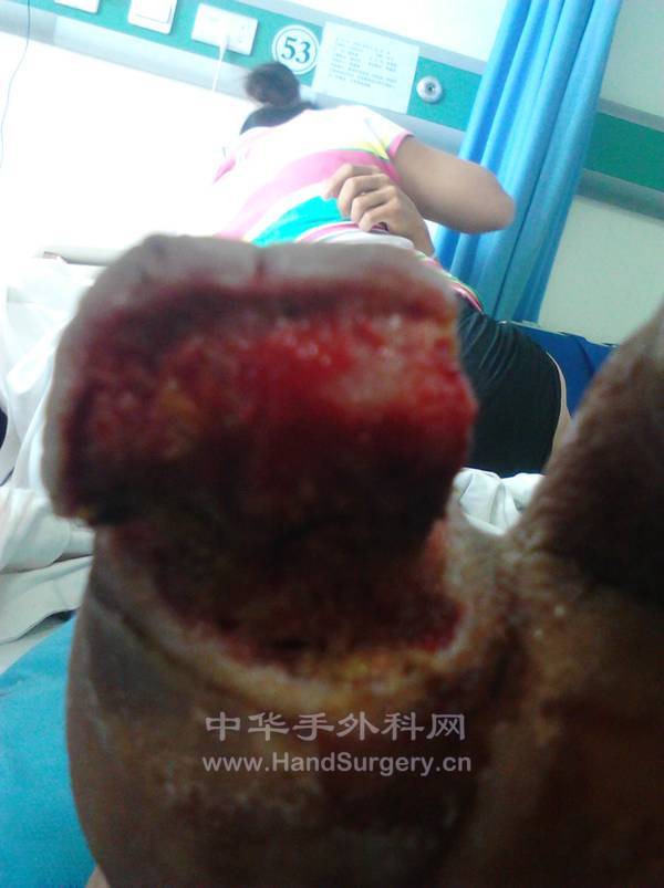 IMG_20120620_103543.jpg
