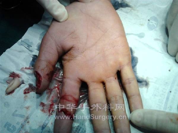 UMHL7AJKK3)O`4E]ILXS@J9.jpg